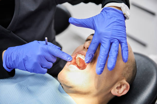 Best Emergency Dental Care for Abscessed Tooth in Lake Telemark, NJ