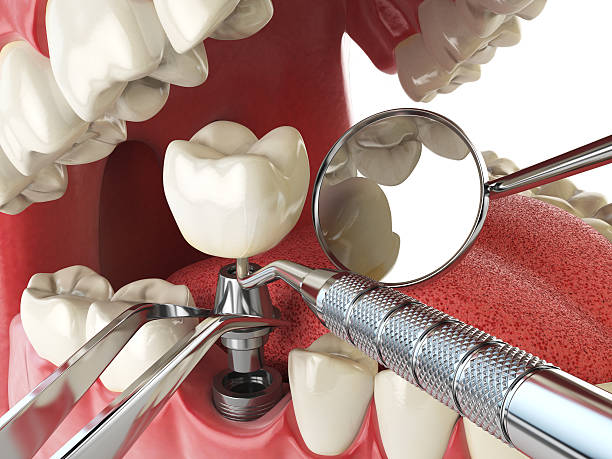Best Emergency Dental Extractions in Lake Telemark, NJ