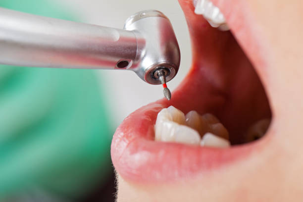 Best Emergency Dentist for Knocked-Out Tooth in Lake Telemark, NJ